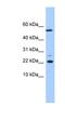 DnaJ Heat Shock Protein Family (Hsp40) Member C24 antibody, NBP1-56748, Novus Biologicals, Western Blot image 