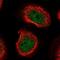 Chromosome 8 Open Reading Frame 44 antibody, NBP1-90418, Novus Biologicals, Immunofluorescence image 