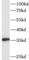 Nitric Oxide Synthase Interacting Protein antibody, FNab09881, FineTest, Western Blot image 