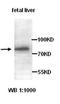 ATP Binding Cassette Subfamily G Member 8 antibody, orb76995, Biorbyt, Western Blot image 