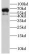 Protein Tyrosine Phosphatase Non-Receptor Type 5 antibody, FNab06939, FineTest, Western Blot image 