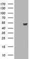 Thymidine Phosphorylase antibody, TA801096S, Origene, Western Blot image 