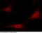 Protein arginine N-methyltransferase 1 antibody, 100805-T10, Sino Biological, Immunohistochemistry paraffin image 