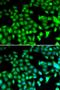 NIMA Related Kinase 2 antibody, orb167269, Biorbyt, Immunofluorescence image 