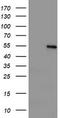 Lipoprotein Lipase antibody, TA503790S, Origene, Western Blot image 