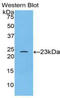 Spectrin alpha chain, brain antibody, LS-C292771, Lifespan Biosciences, Western Blot image 