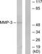 Stromelysin-1 antibody, TA313102, Origene, Western Blot image 