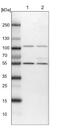 2-Hydroxyacyl-CoA Lyase 1 antibody, NBP1-89384, Novus Biologicals, Western Blot image 
