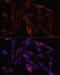OXA1L Mitochondrial Inner Membrane Protein antibody, 22-110, ProSci, Immunofluorescence image 