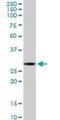 CTRP1 antibody, H00114897-M01, Novus Biologicals, Western Blot image 