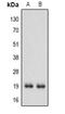 Interferon Alpha 13 antibody, orb319058, Biorbyt, Western Blot image 