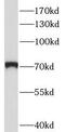 Protein S antibody, FNab06803, FineTest, Western Blot image 