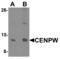 Centromere Protein W antibody, MBS153704, MyBioSource, Western Blot image 