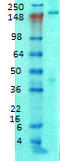 Ankyrin-2 antibody, LS-B8163, Lifespan Biosciences, Western Blot image 