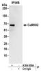 Calcium/Calmodulin Dependent Protein Kinase Kinase 2 antibody, A304-009A, Bethyl Labs, Immunoprecipitation image 
