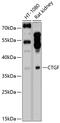 Connective tissue growth factor antibody, 13-902, ProSci, Western Blot image 