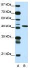ETS translocation variant 5 antibody, TA330224, Origene, Western Blot image 