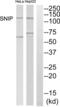 SRC Kinase Signaling Inhibitor 1 antibody, abx015104, Abbexa, Western Blot image 