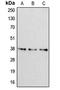 Apolipoprotein F antibody, LS-C351824, Lifespan Biosciences, Western Blot image 