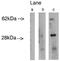 LAG1 longevity assurance homolog 4 antibody, orb109372, Biorbyt, Western Blot image 