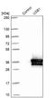 U6 SnRNA Biogenesis Phosphodiesterase 1 antibody, NBP1-82268, Novus Biologicals, Western Blot image 