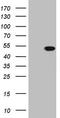 Alpha-Methylacyl-CoA Racemase antibody, TA808476S, Origene, Western Blot image 