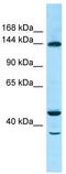 TBC1 Domain Family Member 4 antibody, TA343344, Origene, Western Blot image 