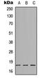 Synaptotagmin 8 antibody, GTX56122, GeneTex, Western Blot image 