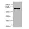 Arachidonate 15-Lipoxygenase Type B antibody, A56791-100, Epigentek, Western Blot image 