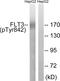 Fms Related Tyrosine Kinase 3 antibody, AP55755PU-S, Origene, Western Blot image 