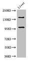 Pleckstrin Homology Like Domain Family B Member 2 antibody, CSB-PA803110LA01HU, Cusabio, Western Blot image 