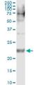 Ccn5 antibody, H00008839-M09, Novus Biologicals, Immunoprecipitation image 