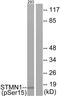 Lag antibody, PA5-39701, Invitrogen Antibodies, Western Blot image 