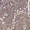 Mitochondrial Ribosomal Protein L48 antibody, HPA040864, Atlas Antibodies, Immunohistochemistry paraffin image 