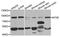 5'-Nucleotidase Ecto antibody, A2029, ABclonal Technology, Western Blot image 