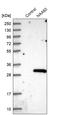 N(Alpha)-Acetyltransferase 60, NatF Catalytic Subunit antibody, HPA040916, Atlas Antibodies, Western Blot image 