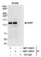 DDB1- and CUL4-associated factor 6 antibody, NBP1-30075, Novus Biologicals, Immunoprecipitation image 