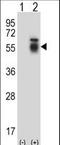 Activin A Receptor Type 1 antibody, LS-C156018, Lifespan Biosciences, Western Blot image 