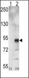 Ephrin type-A receptor 5 antibody, PA5-14582, Invitrogen Antibodies, Western Blot image 