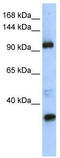 Star-PAP antibody, TA345368, Origene, Western Blot image 