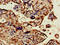 Obscurin Like 1 antibody, CSB-PA016254LA01HU, Cusabio, Immunohistochemistry paraffin image 