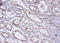Protein Kinase C Substrate 80K-H antibody, A51833-100, Epigentek, Immunohistochemistry paraffin image 