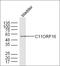 Chromosome 11 Open Reading Frame 16 antibody, orb1154, Biorbyt, Western Blot image 