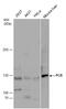 PCB antibody, GTX131987, GeneTex, Western Blot image 