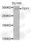 Telomerase Associated Protein 1 antibody, A9844, ABclonal Technology, Western Blot image 