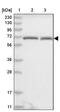 Phenylalanyl-tRNA synthetase beta chain antibody, PA5-57764, Invitrogen Antibodies, Western Blot image 
