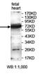 Zinc Finger Protein 300 antibody, orb78056, Biorbyt, Western Blot image 