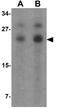 Laforin antibody, GTX31495, GeneTex, Western Blot image 