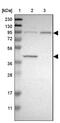 Dual Specificity Tyrosine Phosphorylation Regulated Kinase 1A antibody, NBP1-84032, Novus Biologicals, Western Blot image 