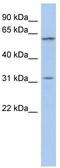 Coiled-Coil Domain Containing 190 antibody, TA333428, Origene, Western Blot image 